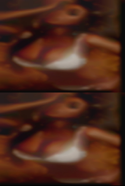 Women sprinter booty poop girl.